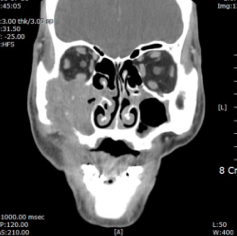스크린샷 2016-07-05 19.38.00