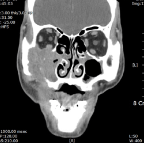 스크린샷 2016-07-05 19.38.00