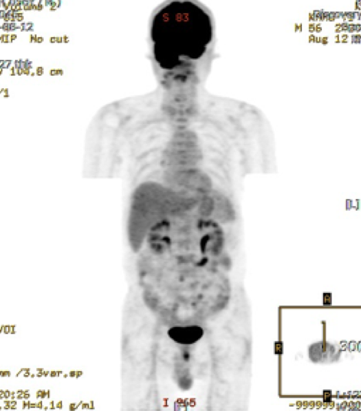 스크린샷 2016-07-05 19.40.16