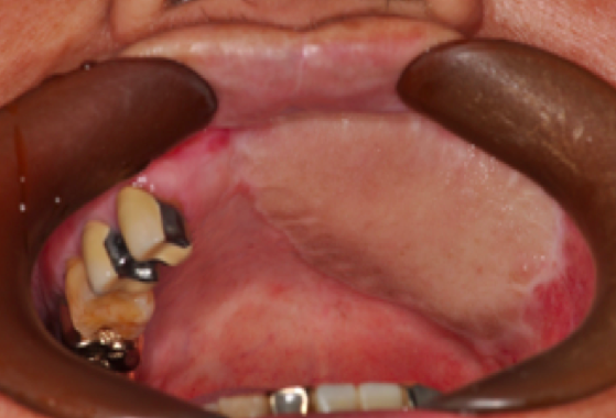 스크린샷 2016-07-05 19.41.15