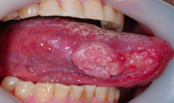 스크린샷 2016-07-05 19.42.17