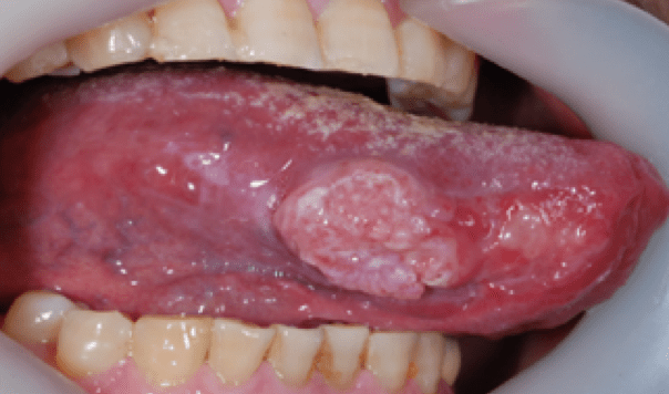 스크린샷 2016-07-05 19.42.17