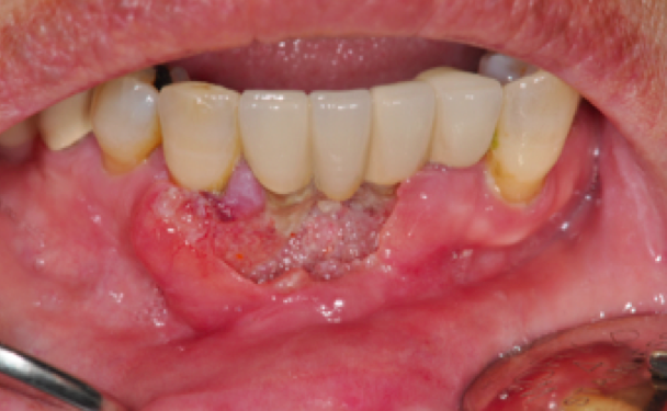 스크린샷 2016-07-05 19.43.00