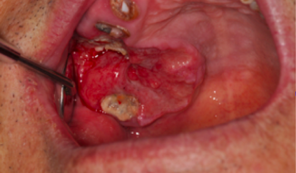 스크린샷 2016-07-05 19.43.47