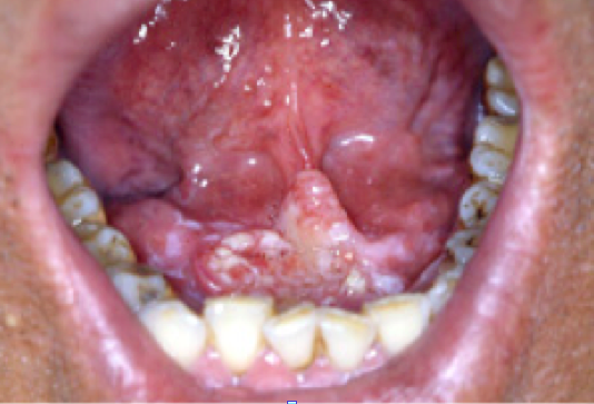 스크린샷 2016-07-05 19.44.21